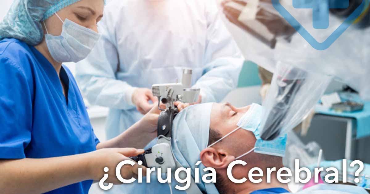 Cirugía del cerebro